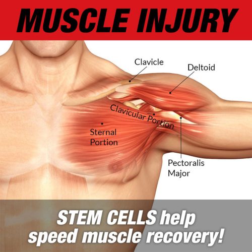 MuscleMeds Stemtropin (60 Kapszula)